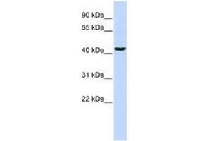 Image no. 1 for anti-GATA Binding Protein 1 (Globin Transcription Factor 1) (GATA1) (AA 36-85) antibody (ABIN6741508) (GATA1 抗体  (AA 36-85))