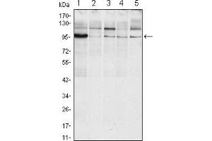 Western blot analysis using ERN1 mouse mAb against Raji (1), A431 (2), Jurkat (3), Hela(4) and HEK293 (5) cell lysate. (ERN1 抗体  (AA 282-433))