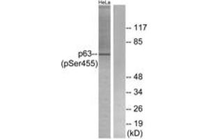 Western blot analysis of extracts from HeLa cells treated with TNF 2500U/ML 30', using p63 (Phospho-Ser455) Antibody. (TCP1 alpha/CCTA 抗体  (pSer455))
