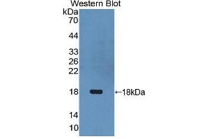 Western blot analysis of the recombinant protein. (Thymic Stromal Lymphopoietin 抗体  (AA 29-159))