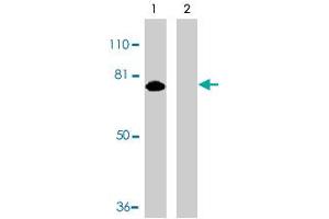 Western blot analysis of MTA2 expression in HeLa whole cell lysates in the absence (lane 1) or presence (lane 2) of blocking peptide with MTA2 polyclonal antibody  at 1 ug /mL . (MTA2 抗体  (AA 652-668))