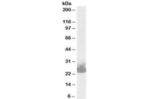 Western blot testing of mouse brain lysate with SNAP25 antibody at 0. (SNAP25 抗体)
