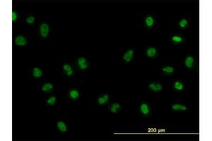 Immunofluorescence of monoclonal antibody to FOXA1 on HeLa cell. (FOXA1 抗体  (AA 367-472))