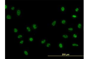 Immunofluorescence of monoclonal antibody to FOXA1 on HeLa cell.