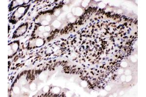 Immunohistochemistry (IHC) image for anti-Cyclin T1 (CCNT1) (AA 375-410), (Middle Region) antibody (ABIN4886509)