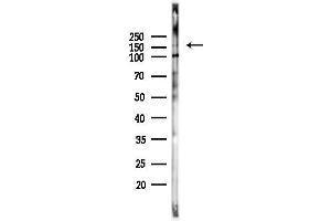 Western blot analysis of lysates from PC12 cells(heat-shock,45 min treatment), using C/gp130 Antibody at 1/1000 dilution.
