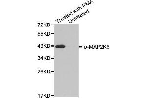 Western blot analysis of extracts from HL60 cells, using phospho-MAP2K6-S207 antibody (MAP2K6 抗体  (pSer207))