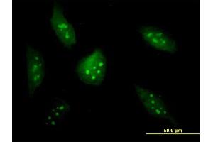 Immunofluorescence of purified MaxPab antibody to BXDC2 on HeLa cell. (BRIX1 抗体  (AA 1-353))