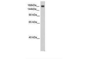 Image no. 2 for anti-Sodium Channel, Voltage-Gated, Type V, alpha Subunit (SCN5A) (AA 1856-1905) antibody (ABIN6736314) (SCN5A 抗体  (AA 1856-1905))