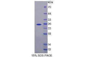 SDS-PAGE analysis of Mouse IHPK3 Protein. (IP6K3 蛋白)