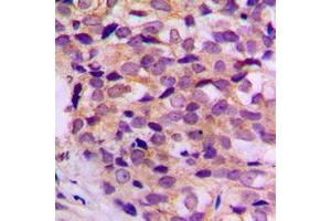 Immunohistochemistry (IHC) image for anti-ATP Synthase, H+ Transporting, Mitochondrial F0 Complex, Subunit C1 (Subunit 9) (ATP5G1) (Center) antibody (ABIN7300386)