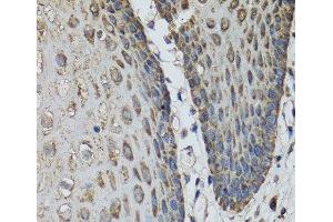 Immunohistochemistry of paraffin-embedded Human esophagus using IL36G Polyclonal Antibody at dilution of 1:100 (40x lens). (IL1F9 抗体)
