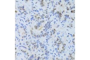 Immunohistochemistry (Paraffin-embedded Sections) (IHC (p)) image for anti-serine/arginine-Rich Splicing Factor 1 (SRSF1) (pSer1) antibody (ABIN3022320)