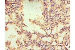 Immunohistochemistry of paraffin-embedded human lung tissue using ABIN7161903 at dilution of 1:100 (NR2C1 抗体  (AA 1-240))