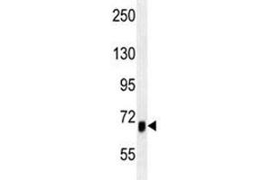 Western Blotting (WB) image for anti-Activin A Receptor, Type IB (ACVR1B) antibody (ABIN3029854)