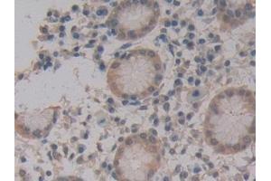 Detection of MPG1 in Human Stomach Tissue using Polyclonal Antibody to Macrophage Expressed Gene 1 Protein (MPG1) (MPEG1 抗体  (AA 313-580))