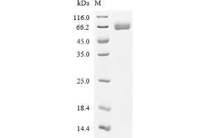 (Tris-Glycine gel) Discontinuous SDS-PAGE (reduced) with 5 % enrichment gel and 15 % separation gel.