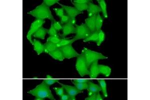 Immunofluorescence analysis of A549 cells using PRKD3 Polyclonal Antibody (PRKD3 抗体)
