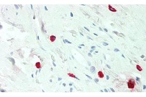 Detection of HA in Human Mast Cells of Colon Tissue using Monoclonal Antibody to Histamine (HA) (Histamine 抗体)