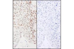Immunohistochemistry (IHC) image for anti-X-Ray Repair Complementing Defective Repair in Chinese Hamster Cells 1 (XRCC1) (pSer461) antibody (ABIN7449389)