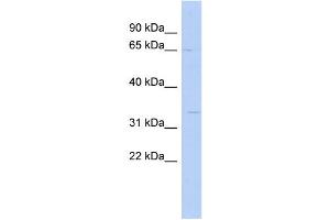 WB Suggested Anti-SC5DL Antibody Titration: 0. (SC5DL 抗体  (N-Term))