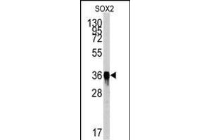 Western blot analysis of SOX2 Antibody (ABIN387798 and ABIN2843854) by SOX2 recombinant protein. (SOX2 抗体)