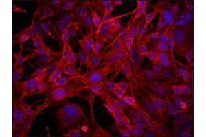 Immunofluorescence (IF) image for anti-CD68 Molecule (CD68) antibody (ABIN2664804) (CD68 抗体)