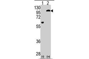 Western blot analysis of PRKCE (arrow) using rabbit PRKCE polyclonal antibody . (PKC epsilon 抗体  (AA 213-243))