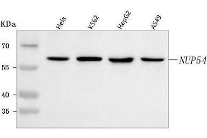 Western blot analysis of NUP54 using anti-NUP54 antibody (ABIN7599968).