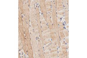 Immunohistochemical analysis of paraffin-embedded human skeletal muscle tissue using (ABIN656961 and ABIN2846145) performed on the Leica® BOND RXm. (CLMP 抗体  (AA 81-110))