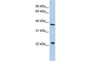 Image no. 1 for anti-DEAD (Asp-Glu-Ala-Asp) Box Polypeptide 25 (DDX25) (AA 180-229) antibody (ABIN6742679) (DDX25 抗体  (AA 180-229))