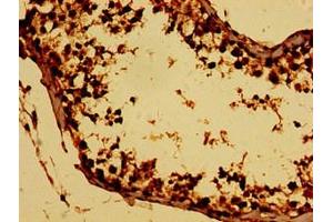 Immunohistochemistry of paraffin-embedded human testis tissue using ABIN7165146 at dilution of 1:100 (BTG4 抗体  (AA 1-206))