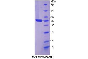 SDS-PAGE (SDS) image for Signal Transducer and Activator of Transcription 3 (Acute-Phase Response Factor) (STAT3) (AA 335-546) protein (His tag) (ABIN4988833) (STAT3 Protein (AA 335-546) (His tag))