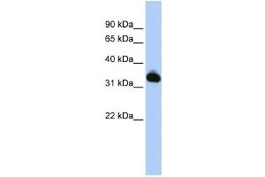 Western Blotting (WB) image for anti-Galactose Mutarotase (Aldose 1-Epimerase) (GALM) antibody (ABIN2459553) (GALM 抗体)