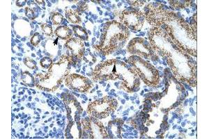 Image no. 1 for anti-Protein L-Myc (MYCL) (AA 135-184) antibody (ABIN202065) (LMYC 抗体  (AA 135-184))