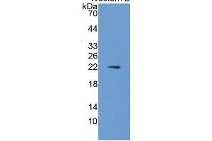 WB of Protein Standard: different control antibodies  against Highly purified E. (IL1A ELISA 试剂盒)