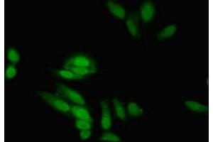 Immunofluorescent analysis of Hela cells using ABIN7152217 at dilution of 1:100 and Alexa Fluor 488-congugated AffiniPure Goat Anti-Rabbit IgG(H+L) (EIF5A2 抗体  (AA 2-153))