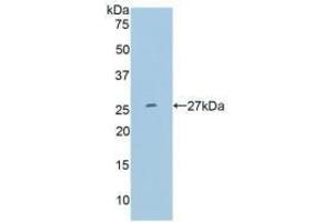 Detection of Recombinant MMP11, Human using Polyclonal Antibody to Matrix Metalloproteinase 11 (MMP11) (MMP11 抗体  (AA 277-488))