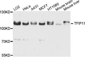 Western blot analysis of extract of various cells, using TFIP11 antibody. (TFIP11 抗体)