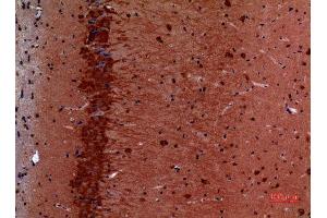 Immunohistochemistry (IHC) image for anti-Heat Shock Protein 90 (HSP90) (Lys284), (Lys292) antibody (ABIN3187840)