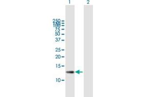 Western Blot analysis of ZSWIM7 expression in transfected 293T cell line by ZSWIM7 MaxPab polyclonal antibody. (ZSWIM7 抗体  (AA 1-140))