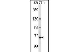 ZN Antibody (N-term ) (ABIN657582 and ABIN2846585) western blot analysis in ZR-75-1 cell line lysates (35 μg/lane). (ZNF135 抗体  (N-Term))