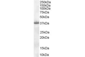 ABIN185372 (0. (NPM1 抗体  (C-Term))