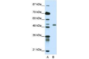 WB Suggested Anti-DEAF1  Antibody Titration: 0. (DEAF1 抗体  (C-Term))