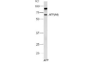 Human AFP lysates probed with Mouse Anti-AFP (A4) Monoclonal Antibody, Unconjugated (bsm-1622M) at 1:300 overnight at 4˚C. (alpha Fetoprotein 抗体)