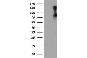 Western Blotting (WB) image for anti-SAM Domain and HD Domain 1 (SAMHD1) antibody (ABIN1500798) (SAMHD1 抗体)