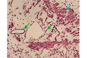 Immunohistochemistry (IHC) image for anti-Potassium Inwardly-Rectifying Channel, Subfamily J, Member 8 (KCNJ8) (AA 382-396), (Intracellular) antibody (ABIN7043489)