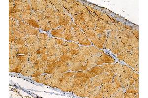 ABIN6257147 and ABIN6274445 at 1/100 staining Rat skin tissue by IHC-P. (DOK4 抗体  (N-Term))