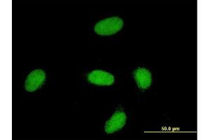 Immunofluorescence of monoclonal antibody to YAP1 on HeLa cell. (YAP1 抗体  (AA 53-161))