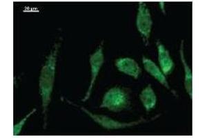 Immunostaining analysis in HeLa cells. (MOB2 抗体)
